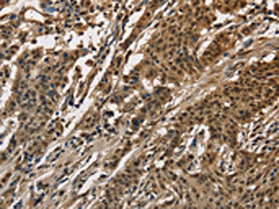 Anti-CCAR1
