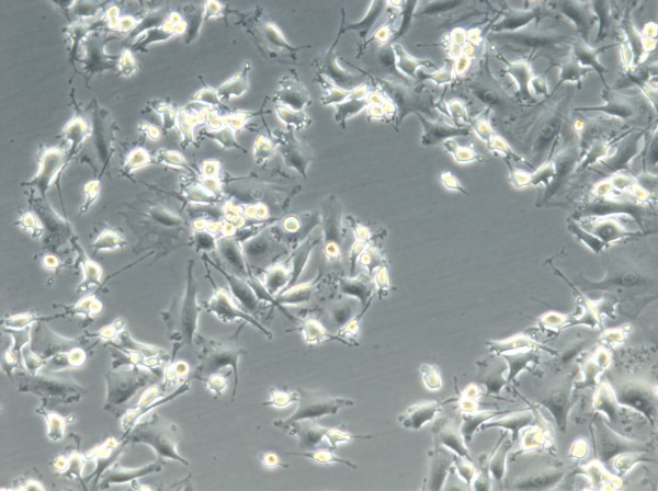 OS1-CLS Cells