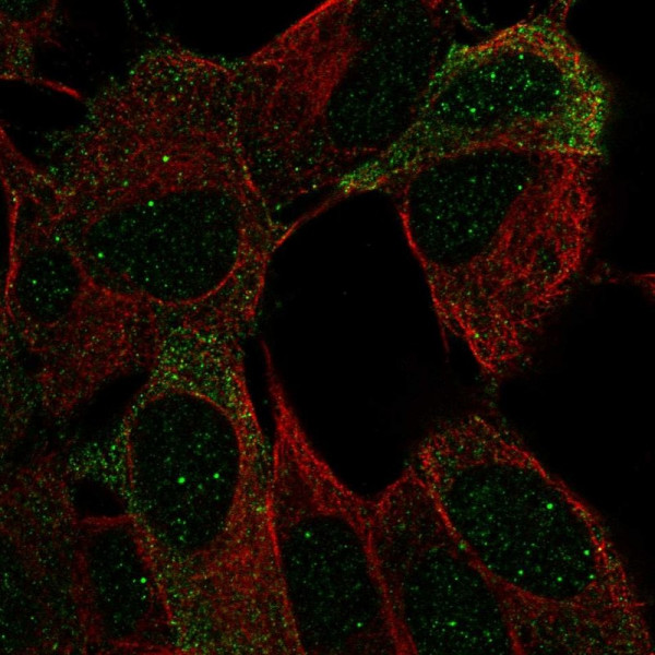 Anti-NCAM2