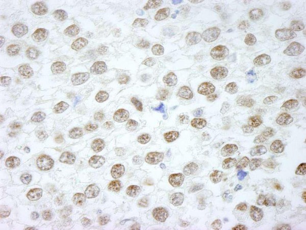 Anti-RIF1 (IHC)