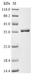 Nucleoside-specific channel-forming protein tsx (tsx), Escherichia coli, recombinant