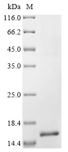 Fragile X mental retardation syndrome-related protein 1 (FXR1), partial, human, recombinant