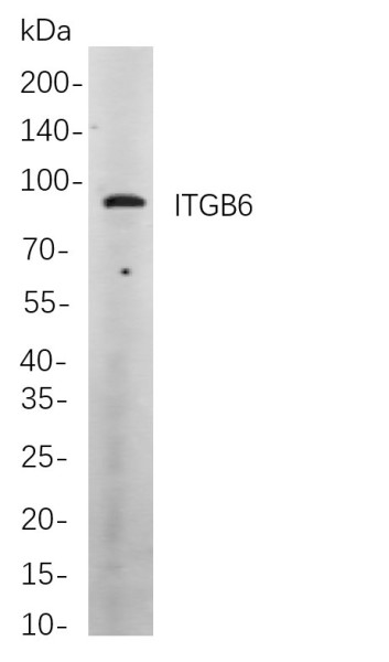 Anti-Recombinant ITGB6, clone 9A5