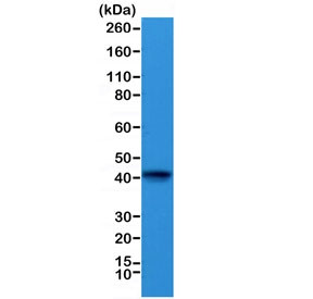 Anti-Alpha Cardiac Actin / ACTC1, clone RM257 (recombinant antibody)