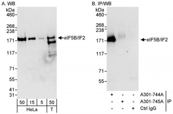 Anti-eIF5B/IF2