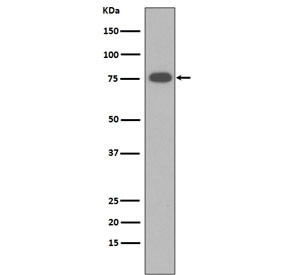 Anti-Vitronectin / VTN, clone DCC-22