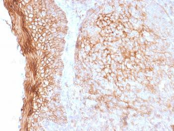 Anti-CD73 (Immuno-Oncology Target) Monoclonal Antibody (Clone: NT5E/2505)
