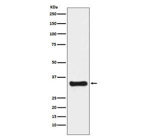 Anti-Thymidylate Synthase, clone ADAA-20