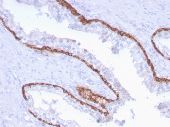 Anti-KRT15 / Cytokeratin 15, clone KRT15/2959