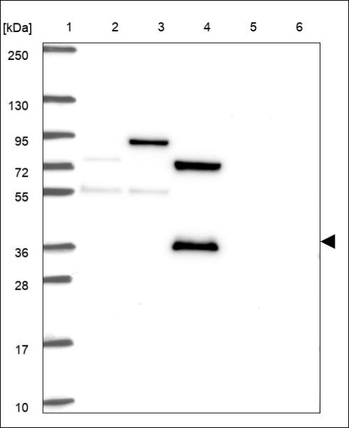 Anti-KCNAB3