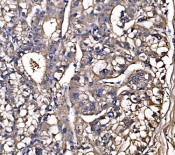 Anti-LSR / Lipolysis-stimulated lipoprotein receptor