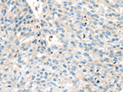 Anti-VPS26A