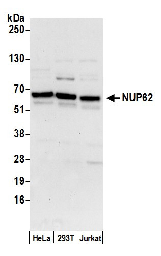 Anti-Nucleoporin p62/NUP62