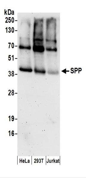 Anti-SPP