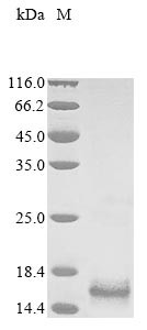 Lysophosphatidic acid receptor 3 (LPAR3), partial, human, recombinant