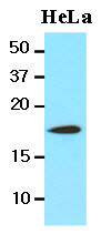 Anti-Cofilin, clone 1C1