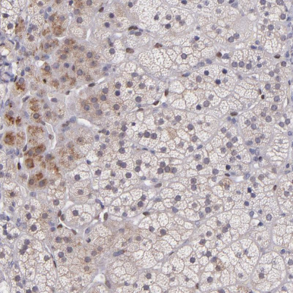 Anti-NUP62CL