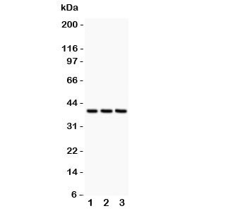 Anti-CXCR6