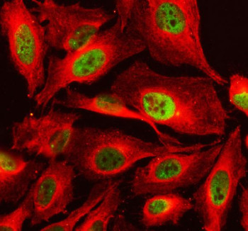 Anti-TAF3 / Transcription initiation factor TFIID subunit 3