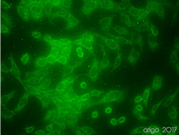 Anti-Pyruvate Dehydrogenase E1-alpha subunit, clone 3H2-F8-B5