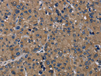 Anti-TRPM1