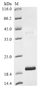 Transforming growth factor beta-2 proprotein (TGFB2), partial, bovine, recombinant