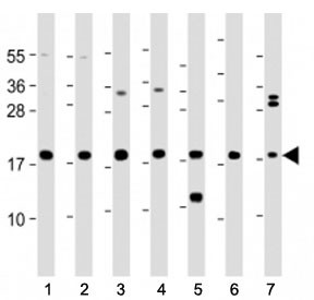 Anti-ARPC5 / p16 ARC