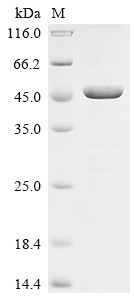 Neutral cholesterol ester hydrolase 1 (NCEH1), partial, human, recombinant