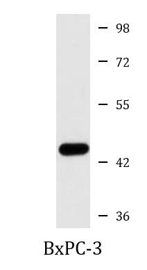 Anti-NPTX2