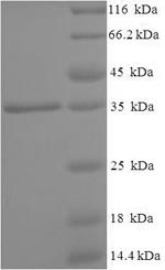 N (4)- (beta-N-acetylglucosaminyl)-L-asparaginase (AGA), partial, human, recombinant