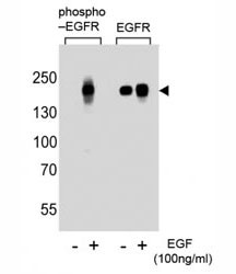 Anti-phospho-EGFR (Ser768)