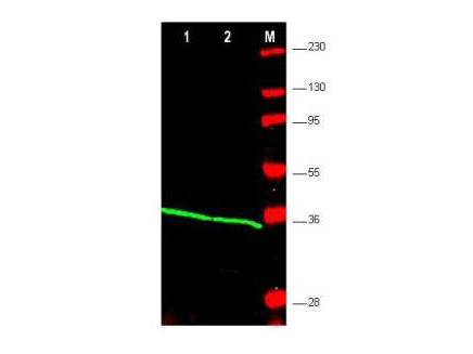 Anti-Proliferating Cell Nuclear Antigen (PCNA)