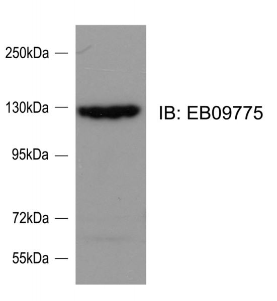 Anti-SRGAP2, Internal