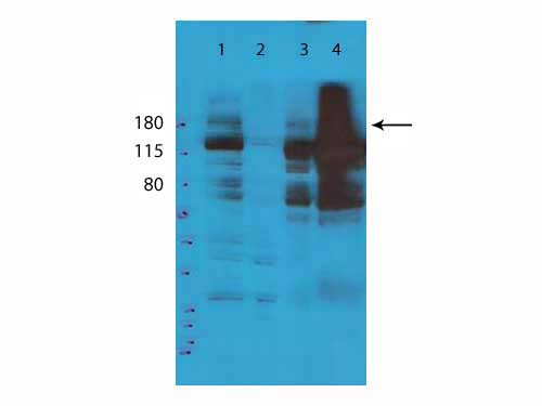 Anti-TET2