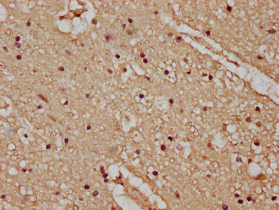Anti-ATP2B4