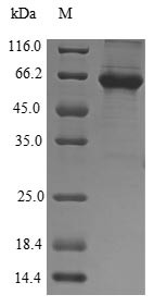 5-Aminolevulinate synthase, erythroid-specific, mitochondrial (ALAS2), human, recombinant