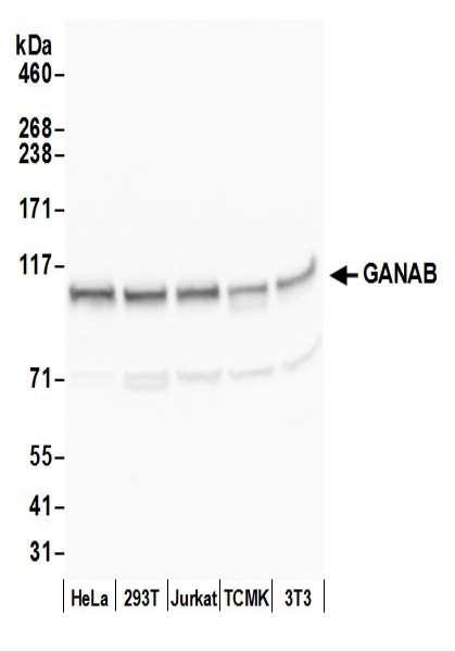 Anti-GANAB/Glucosidase II Subunit alpha