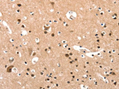 Anti-ELOVL6