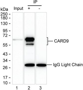 Anti-CARD9