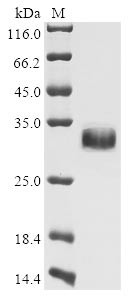 Notch homolog 2 N-terminal-like protein B (NOTCH2NLB), human, recombinant