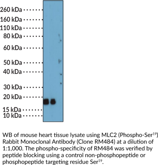 Anti-MLC2 (Phospho-Ser19) Rabbit (Clone RM484