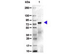 Mouse Transferrin