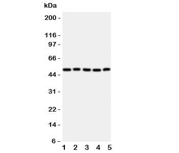 Anti-ALDH3A1