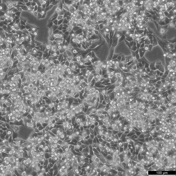 MB49 Cells