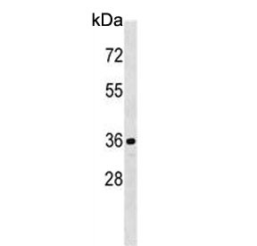 Anti-CDKL1
