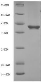 Suppressor of cytokine signaling 3 (Socs3), rat, recombinant