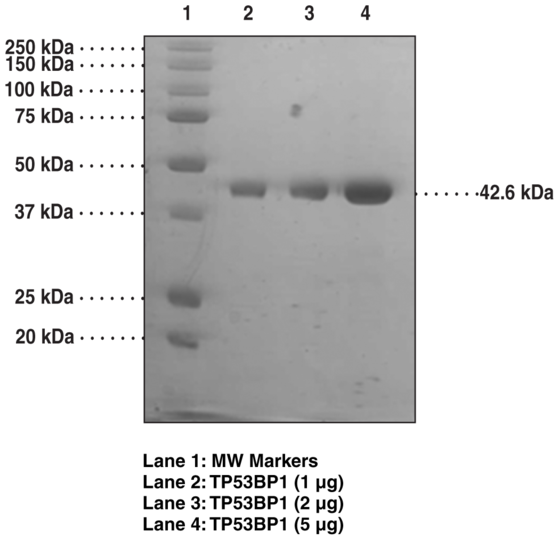 TP53BP1 tudor-like region (human recombinant)
