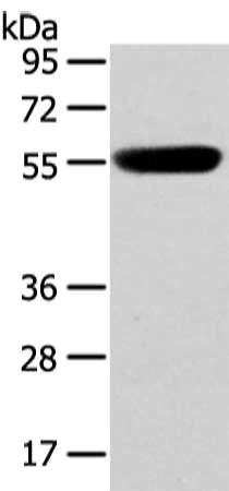 Anti-CBX4