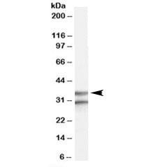 Anti-GPR3