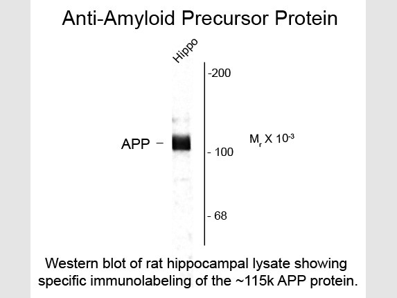 Anti-Beta Amyloid